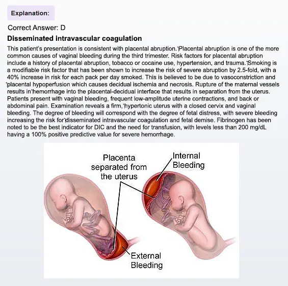 MCAT Sample question and explanation