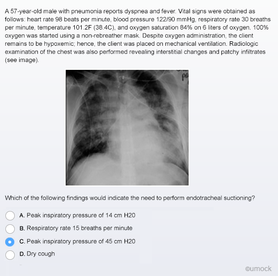 example from nclex practice questions