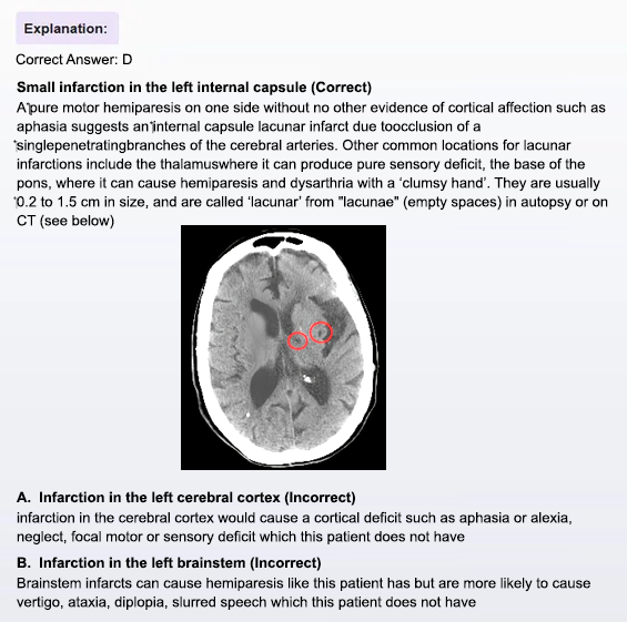 MCAT Sample question and explanation